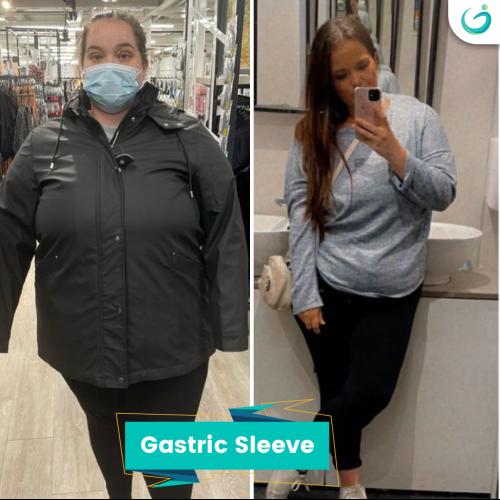 Before after photos of our patients 4